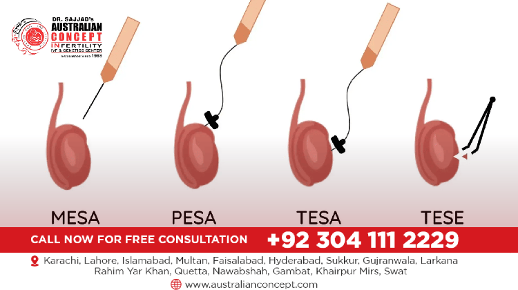 Australian Concept infertility Medical Center